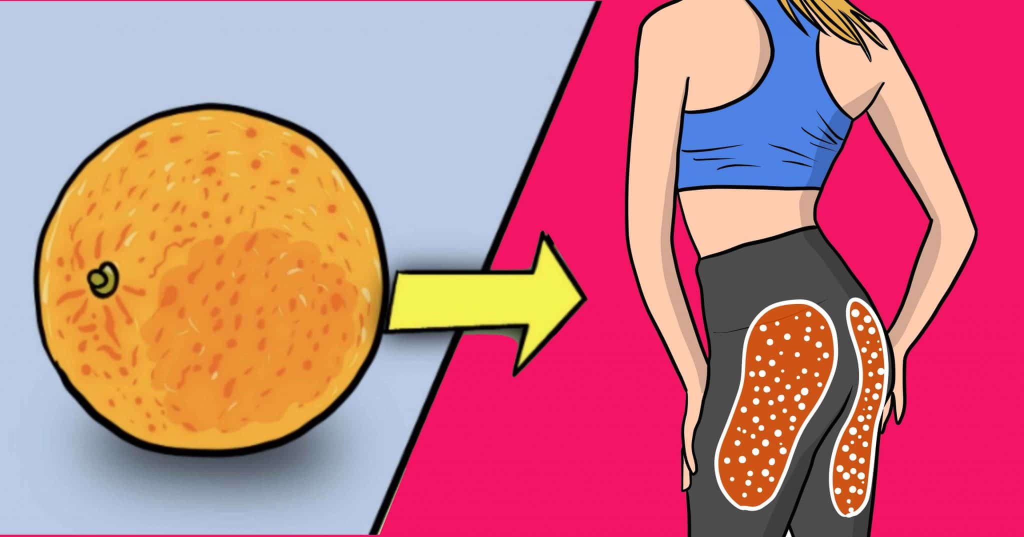 7 Ways To Get Rid Of Cellulite